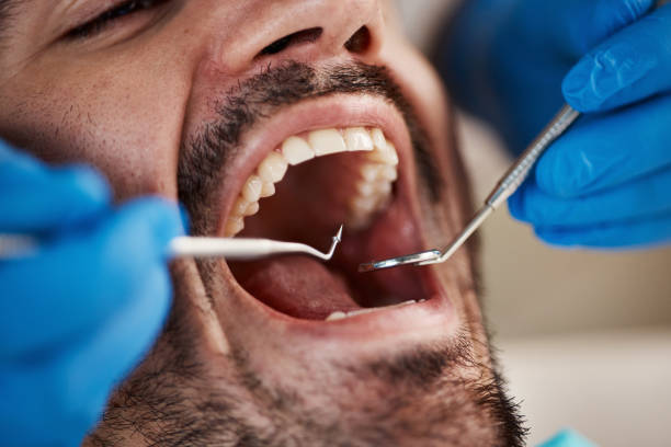 Best Emergency Dentist for Knocked-Out Tooth in Meeker, CO